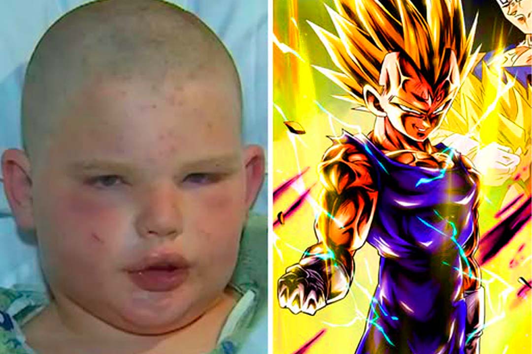 Garoto sobrevive a mais de 400 picadas de abelhas africanas graças a desenho animado