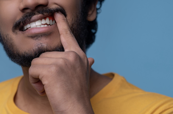 Sangramento na gengiva exige atenção imediata. Foto: FreePik