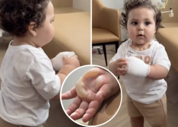 Filho de Viih Tube sofre queimaduras; veja quais são os acidentes domésticos mais comuns com crianças. Foto: Reprodução