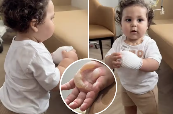 Filho de Viih Tube sofre queimaduras; veja quais são os acidentes domésticos mais comuns com crianças. Foto: Reprodução