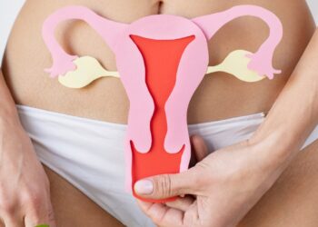 síndrome dos ovários policísticos