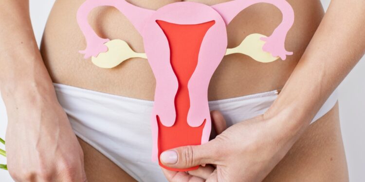 síndrome dos ovários policísticos