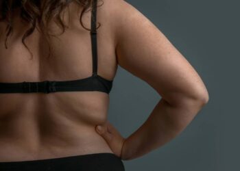 Movimento diário que ajuda a reduzir a gordurinha das costas e melhorar a postura - Créditos: depositphotos.com / serezniy