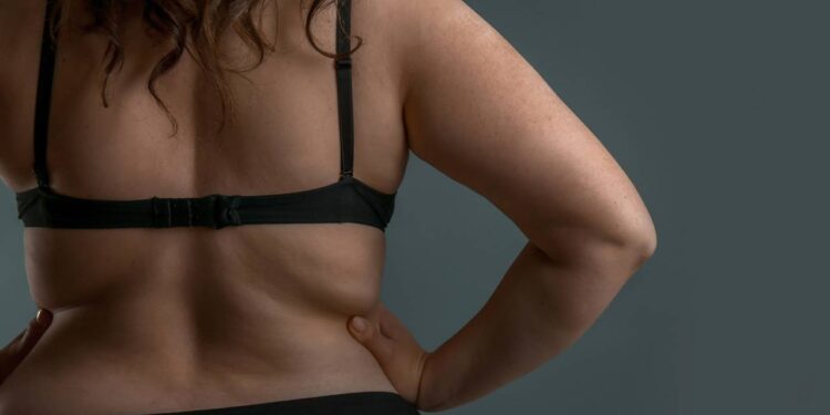 Movimento diário que ajuda a reduzir a gordurinha das costas e melhorar a postura - Créditos: depositphotos.com / serezniy