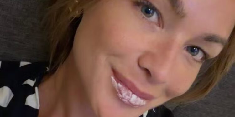 Herpes labial: como cuidar e evitar o surgimento das lesões - Crédito: Reprodução|@ba.heck