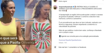 Paolla Oliveira negou ter feito cirurgia na região íntima. Foto: Reprodução