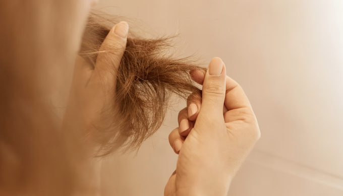 Caneta emagrecedora faz cair cabelo? Foto: FreePik