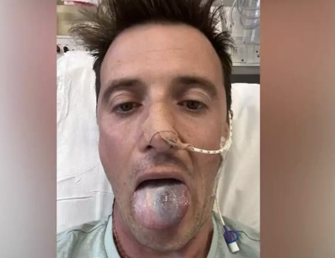 HPV em homens também é preocupante. Entenda. Foto: Anthony Perriam / BBC News Brasil