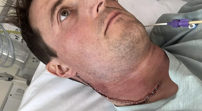 HPV em homens também é preocupante. Entenda. Foto: Anthony Perriam / BBC News Brasil