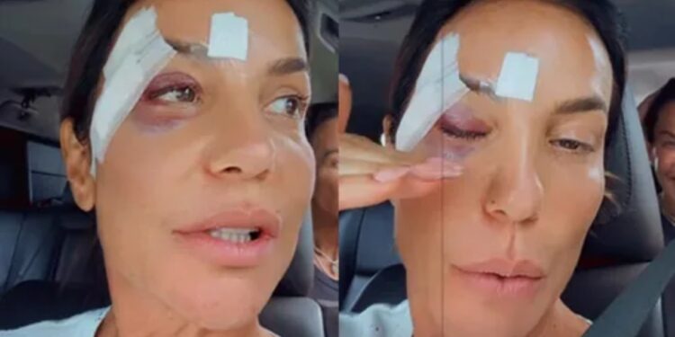 o que aconteceu com ivete sangalo