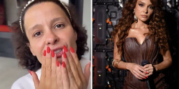 Alopécia androgenética pode ter cura na medicina chinesa. Foto: Reprodução