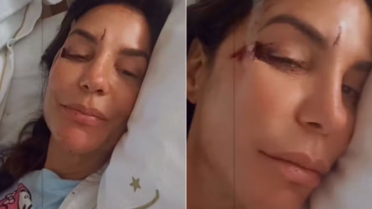 o que aconteceu com ivete sangalo