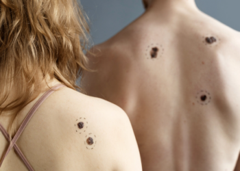 Pintas, manchas e sinais: entenda por que aparecem. Foto: FreePik