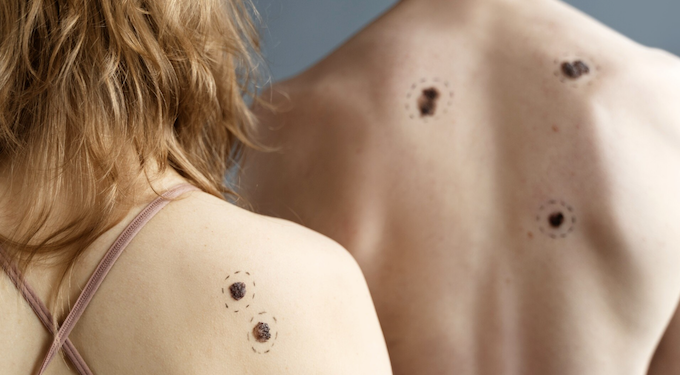 Pintas, manchas e sinais: entenda por que aparecem. Foto: FreePik