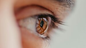 glaucoma