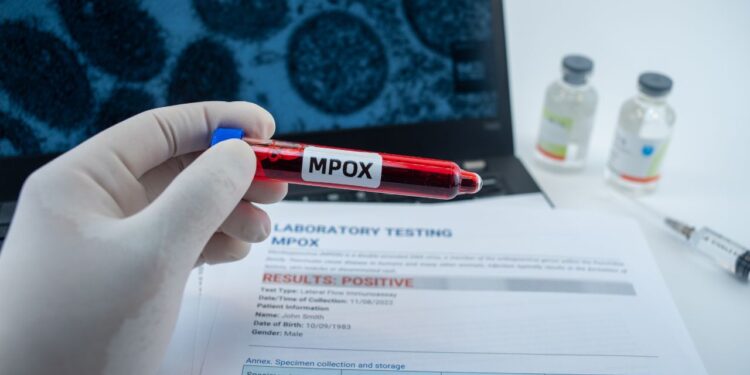 mpox