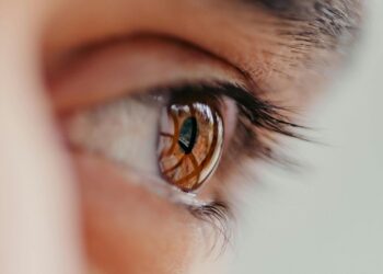 glaucoma