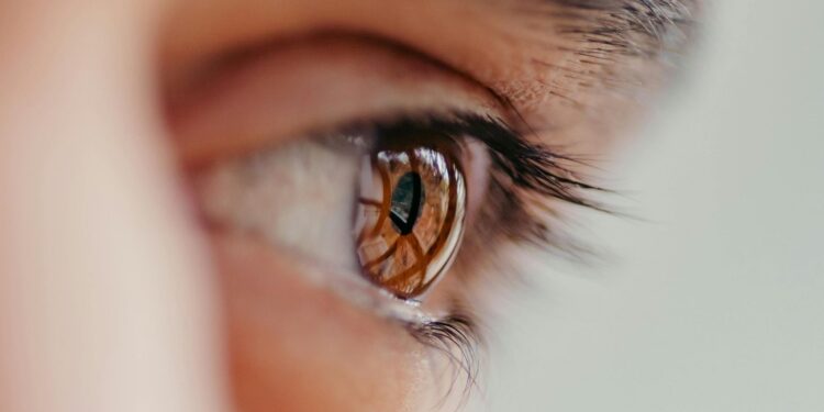 glaucoma