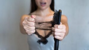 queda-de-cabelo