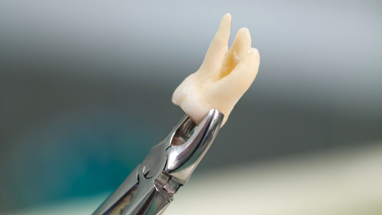 dente-do-siso