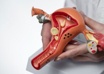 irregularidade menstrual