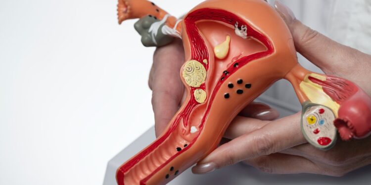 irregularidade menstrual