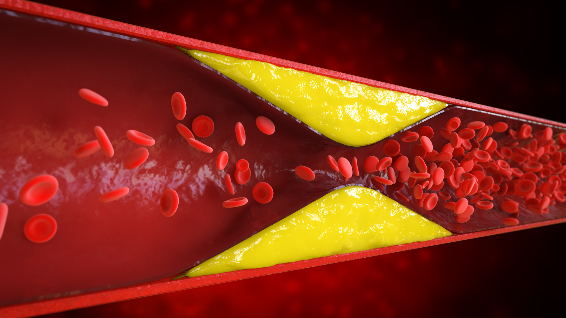 Como baixar o colesterol ruim Descubra alimentos infalíveis para mudar sua dieta. Crédito: Canva