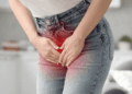 Infecção urinária. Crédito: Canva