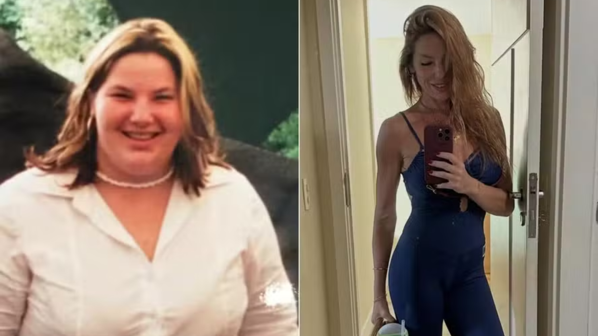 Sequelas da bariátrica marcaram a trajetória da jornalista Luiza Zveiter. Reprodução: Instagram