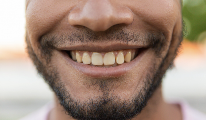 Por que seus dentes estão amarelados? Foto: Magnific