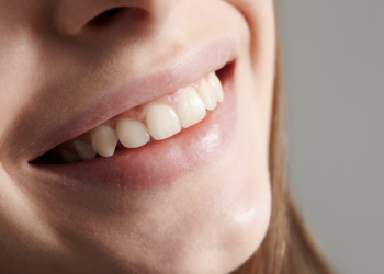 Por que seus dentes estão amarelados? Foto: Magnific