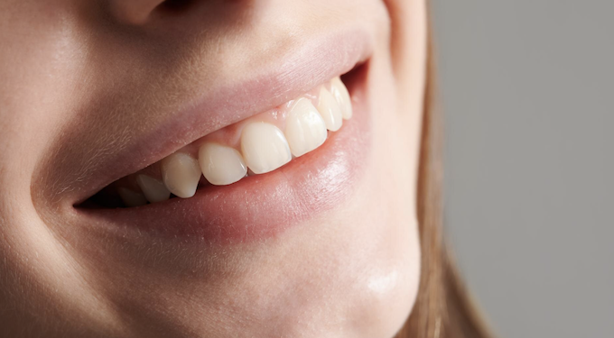 Por que seus dentes estão amarelados? Foto: Magnific